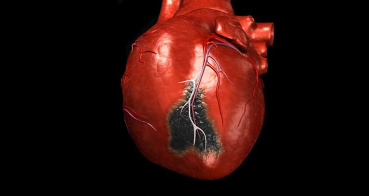 Лікарі пояснили, які емоції провокують інфаркт